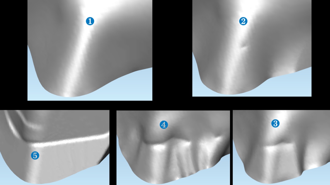 Evolution of wrinkles during forming – Courtesy AP&T